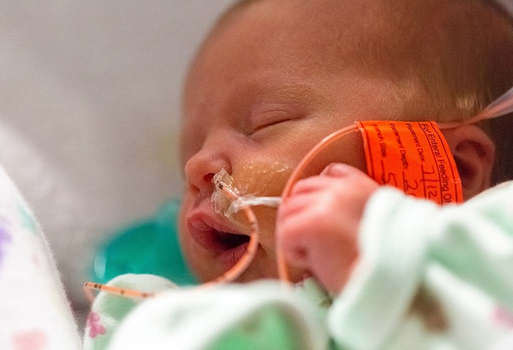 The Procedure for Inserting a Feeding Tube in the Infant's Nose or Mouth